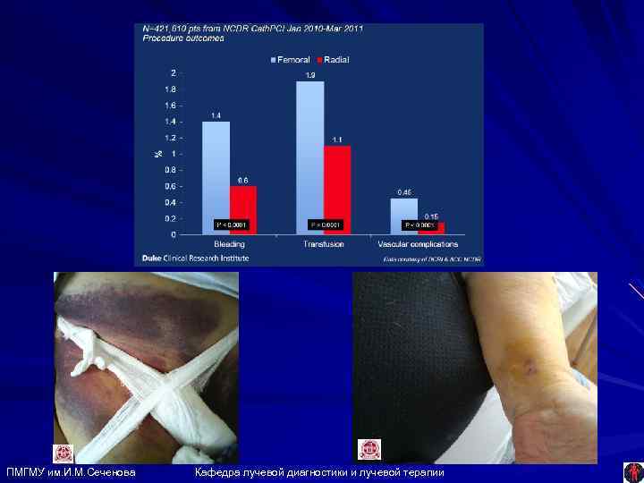 ПМГМУ им. И. М. Сеченова Кафедра лучевой диагностики и лучевой терапии 