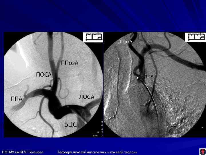 ПМГМУ им. И. М. Сеченова Кафедра лучевой диагностики и лучевой терапии 
