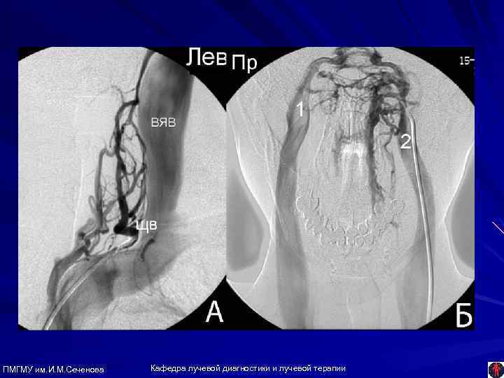 ПМГМУ им. И. М. Сеченова Кафедра лучевой диагностики и лучевой терапии 