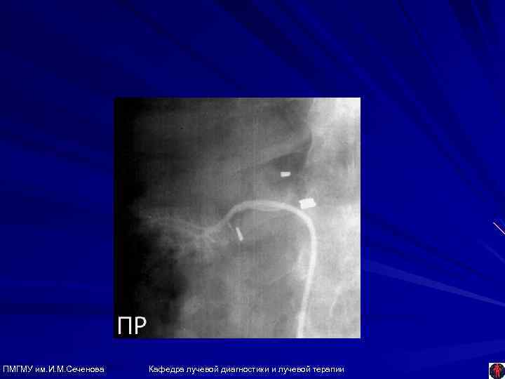 ПМГМУ им. И. М. Сеченова Кафедра лучевой диагностики и лучевой терапии 