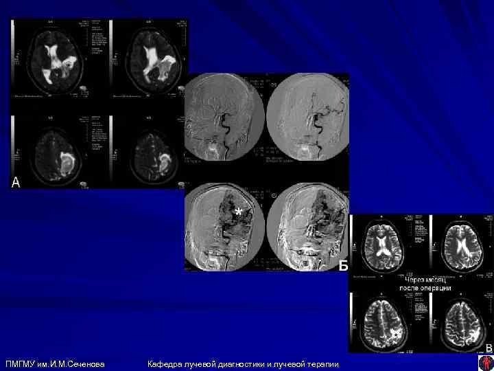 ПМГМУ им. И. М. Сеченова Кафедра лучевой диагностики и лучевой терапии 