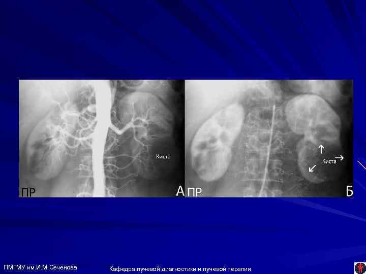ПМГМУ им. И. М. Сеченова Кафедра лучевой диагностики и лучевой терапии 