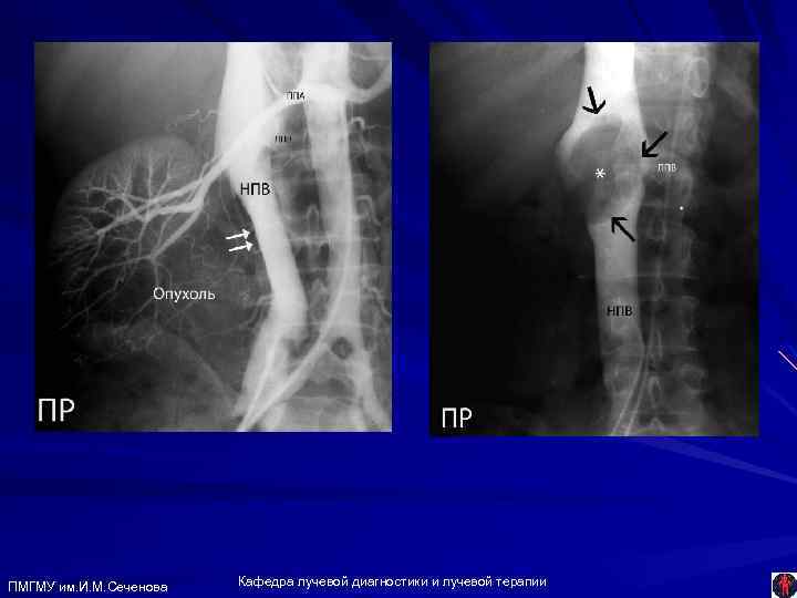 ПМГМУ им. И. М. Сеченова Кафедра лучевой диагностики и лучевой терапии 
