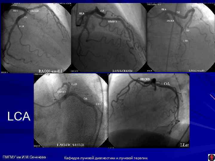 LCA ПМГМУ им. И. М. Сеченова Кафедра лучевой диагностики и лучевой терапии 
