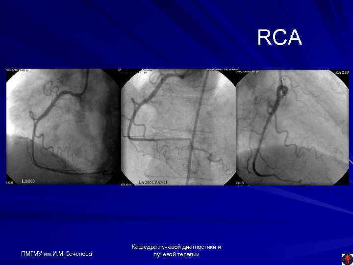 RCA ПМГМУ им. И. М. Сеченова Кафедра лучевой диагностики и лучевой терапии 