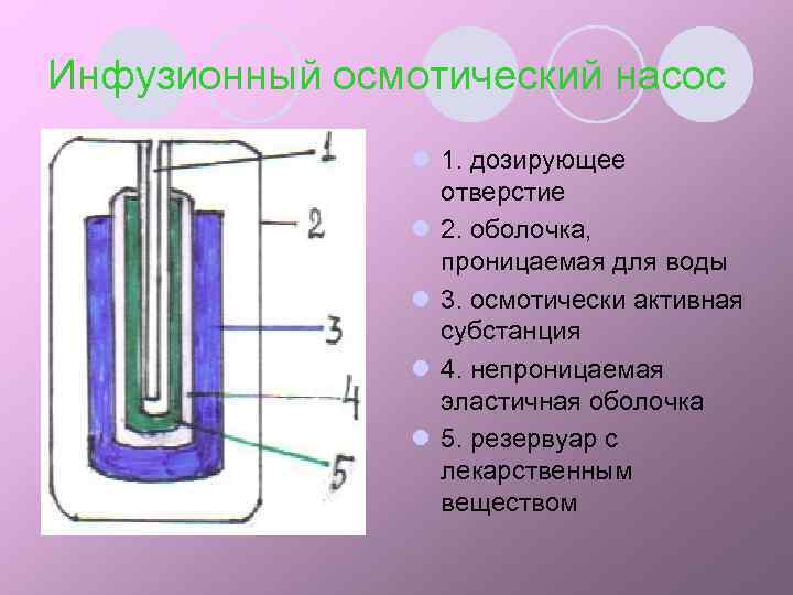 Инфузионный осмотический насос l 1. дозирующее отверстие l 2. оболочка, проницаемая для воды l