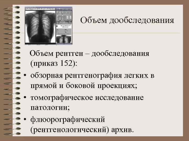 Объем дообследования Объем рентген – дообследования (приказ 152): • обзорная рентгенография легких в прямой