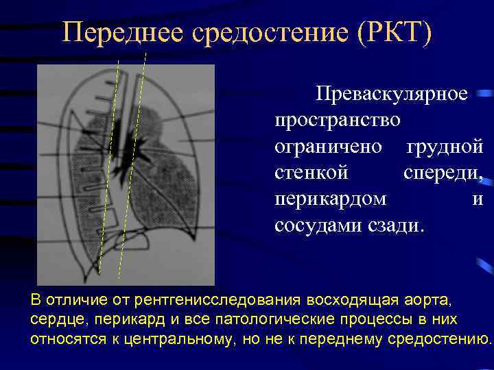 Верхняя стенка средостения