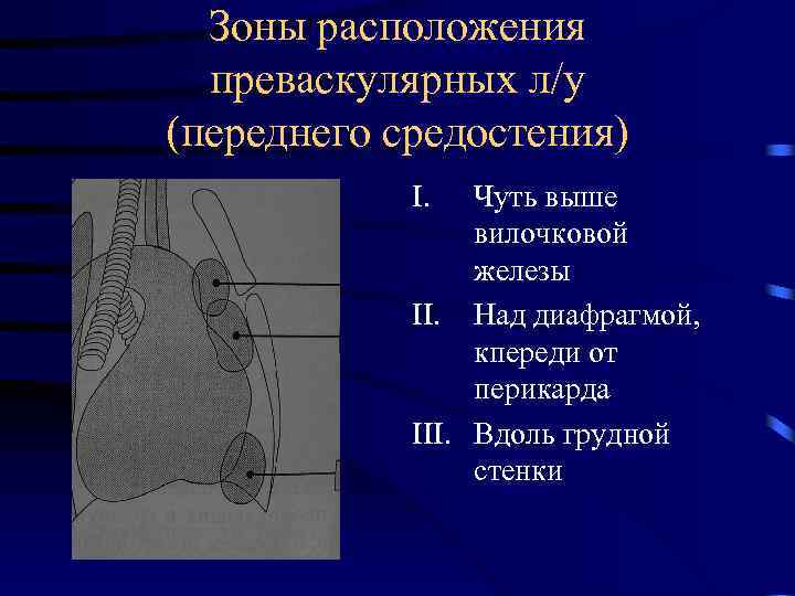 Зоны расположения преваскулярных л/у (переднего средостения) I. Чуть выше вилочковой железы II. Над диафрагмой,