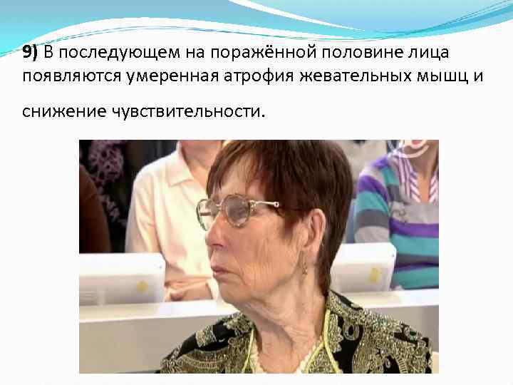 9) В последующем на поражённой половине лица появляются умеренная атрофия жевательных мышц и снижение