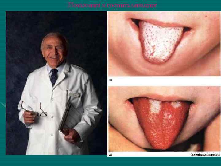 Показания к госпитализации: • наличие модифицирующих факторов риска в течении болезни: — ранний возраст