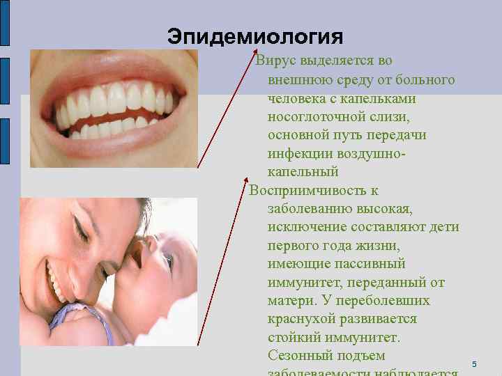 Эпидемиология Вирус выделяется во внешнюю среду от больного человека с капельками носоглоточной слизи, основной