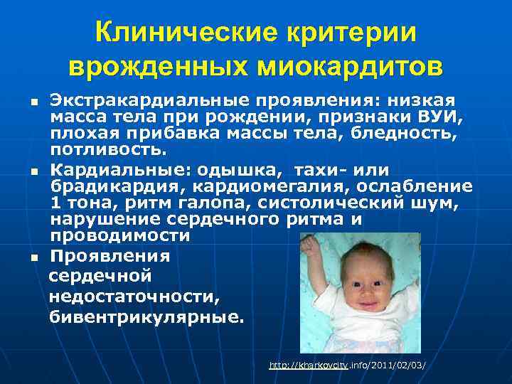 Клинические критерии врожденных миокардитов n n n Экстракардиальные проявления: низкая масса тела при рождении,