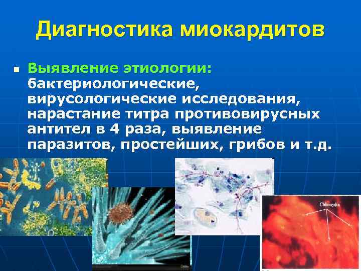 Диагностика миокардитов n Выявление этиологии: бактериологические, вирусологические исследования, нарастание титра противовирусных антител в 4