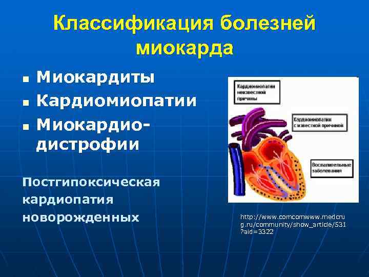 Кардиомиопатии презентация по терапии