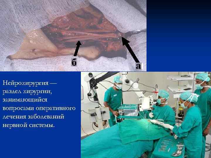 Нейрохирургия — раздел хирургии, занимающийся вопросами оперативного лечения заболеваний нервной системы. 