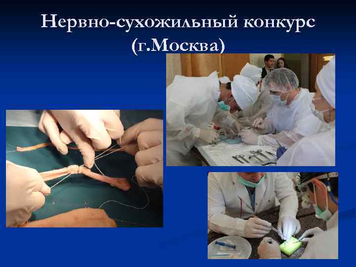 Нервно-сухожильный конкурс (г. Москва) 