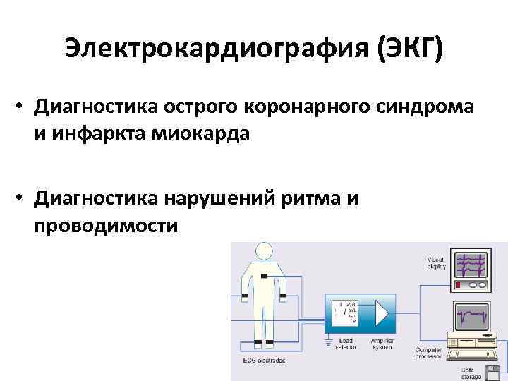 Электрокардиография (ЭКГ) • Диагностика острого коронарного синдрома и инфаркта миокарда • Диагностика нарушений ритма