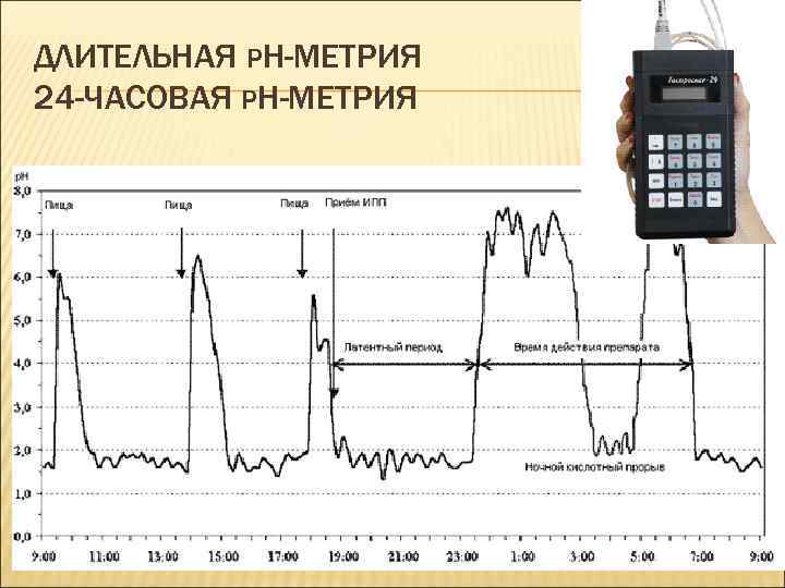 Рн метрия желудка как проводится. 24-Часовая внутрипищеводная PH-метрия. 24 Часовая PH метрия. Внутрижелудочная РН-метрия норма. Внутрижелудочковая РН метрия норма.