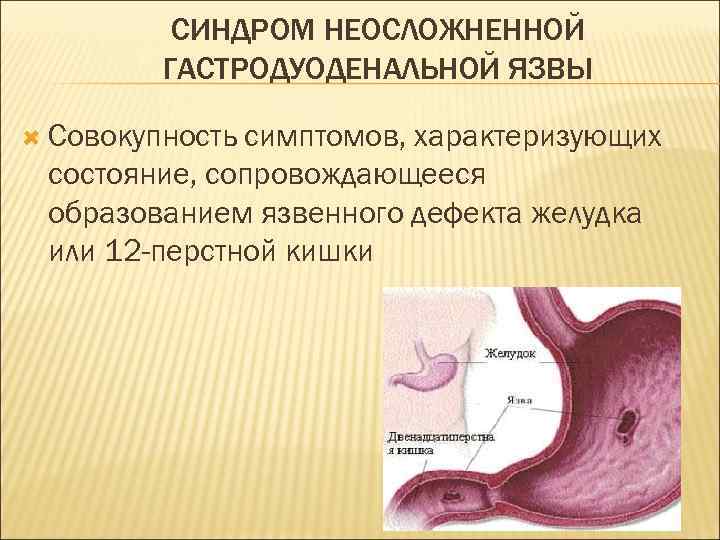 СИНДРОМ НЕОСЛОЖНЕННОЙ ГАСТРОДУОДЕНАЛЬНОЙ ЯЗВЫ Совокупность симптомов, характеризующих состояние, сопровождающееся образованием язвенного дефекта желудка или