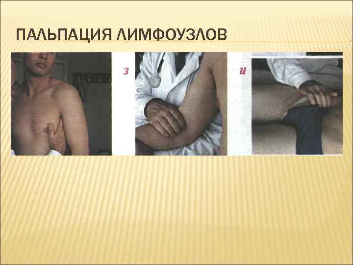ПАЛЬПАЦИЯ ЛИМФОУЗЛОВ 