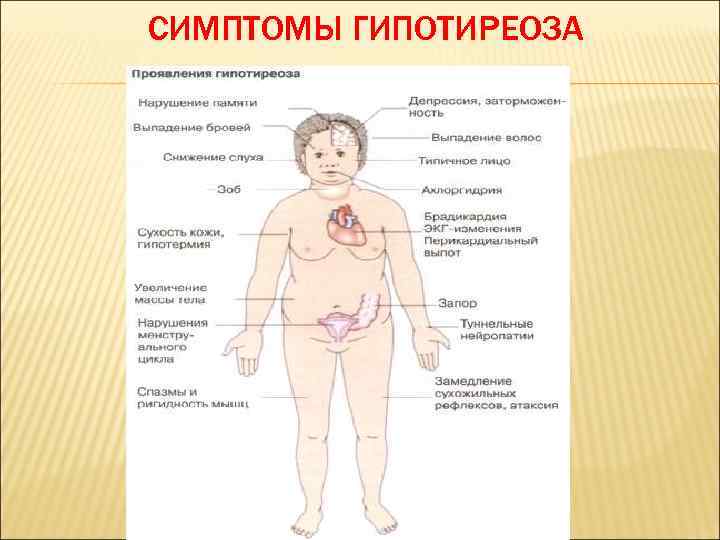 СИМПТОМЫ ГИПОТИРЕОЗА 