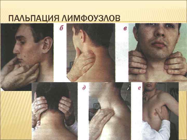 ПАЛЬПАЦИЯ ЛИМФОУЗЛОВ 