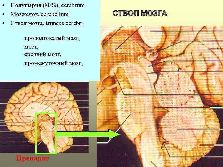  • Полушария (80%), cerebrum • Мозжечок, cerebellum • Ствол мозга, truncus cerebri: продолговатый