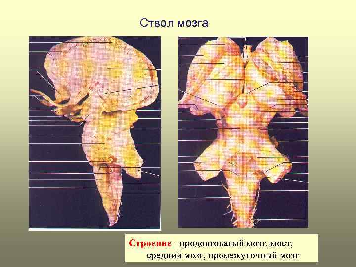 Ствол мозга Строение - продолговатый мозг, мост, средний мозг, промежуточный мозг 
