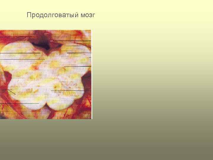 Продолговатый мозг 
