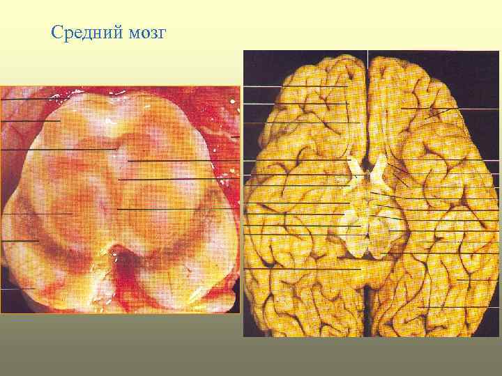 Средний мозг 