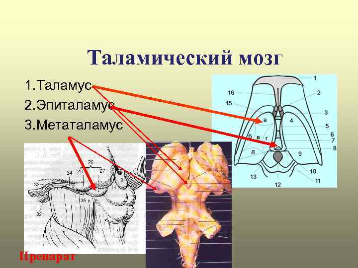 Таламический мозг 1. Таламус 2. Эпиталамус 3. Метаталамус Препарат 