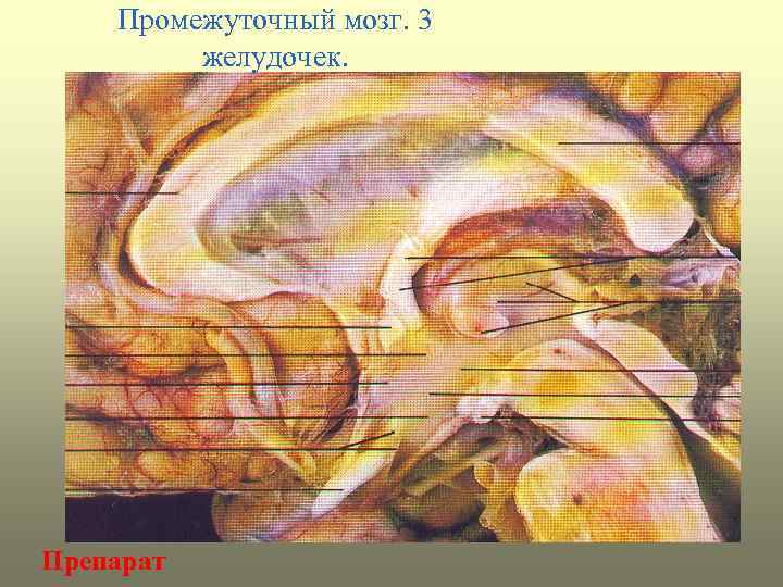 Промежуточный мозг. 3 желудочек. Препарат 
