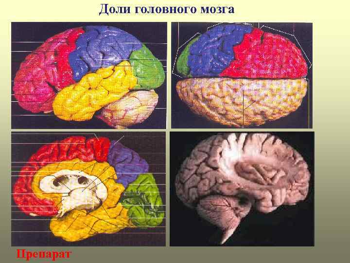 Доли головного мозга Препарат 