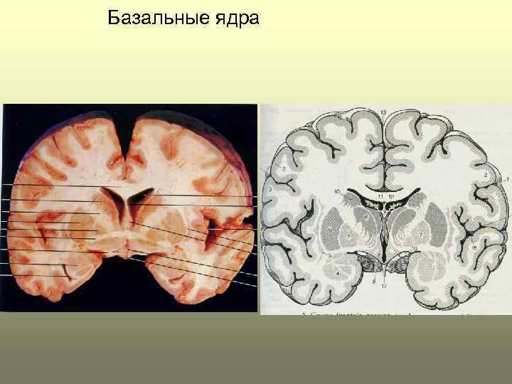 Базальные ядра 