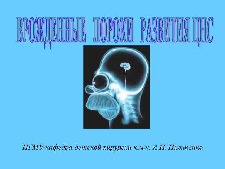 НГМУ кафедра детской хирургии к. м. н. А. Н. Пилипенко 