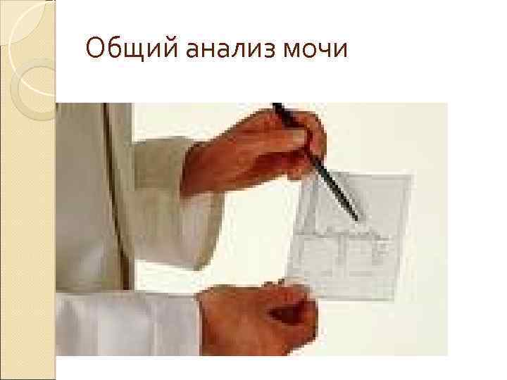 Общий анализ мочи 