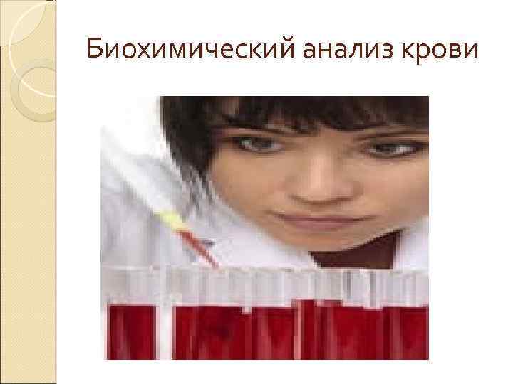 Биохимический анализ крови 