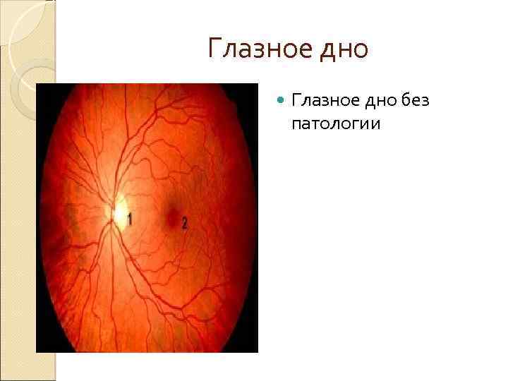 Глазное дно без патологии 
