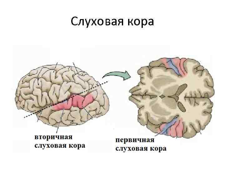 Слуховая кора 