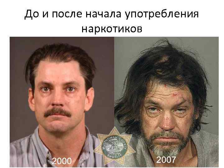 До и после начала употребления наркотиков 