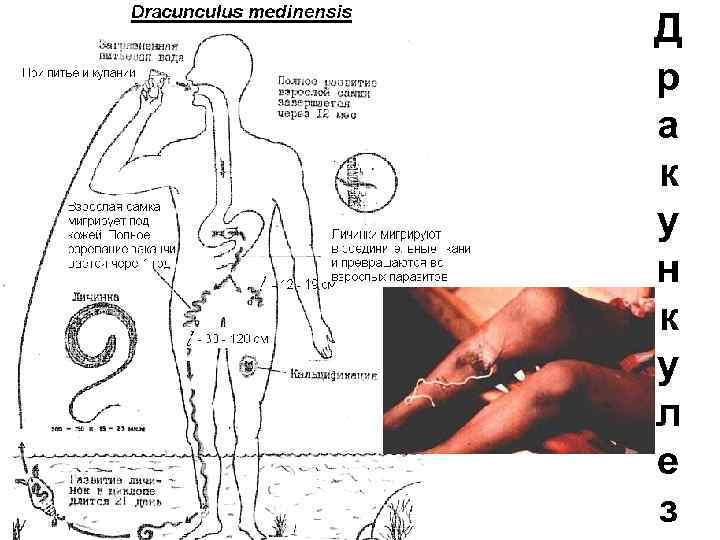 Д р а к у н к у л е з 