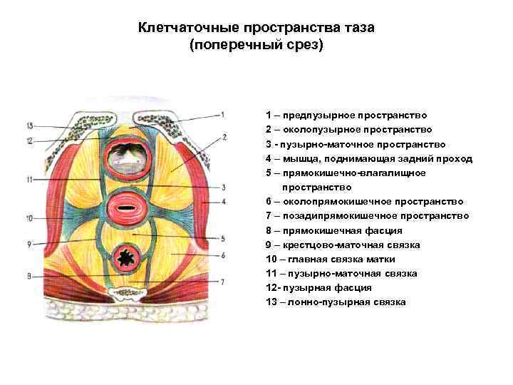 Сагиттальный распил забрюшинного пространства схема