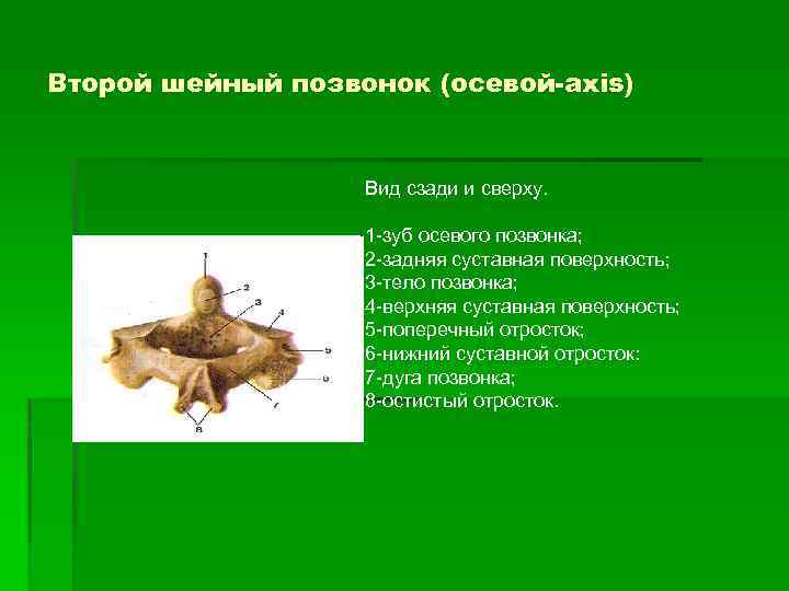 Второй шейный позвонок (осевой-axis) Вид сзади и сверху. 1 -зуб осевого позвонка; 2 -задняя