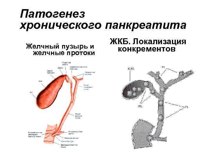 Патогенез хронического панкреатита Желчный пузырь и желчные протоки ЖКБ. Локализация конкрементов 