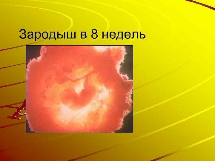 Зародыш в 8 недель 