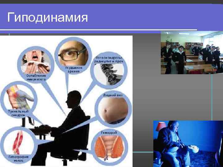 Гиподинамия 