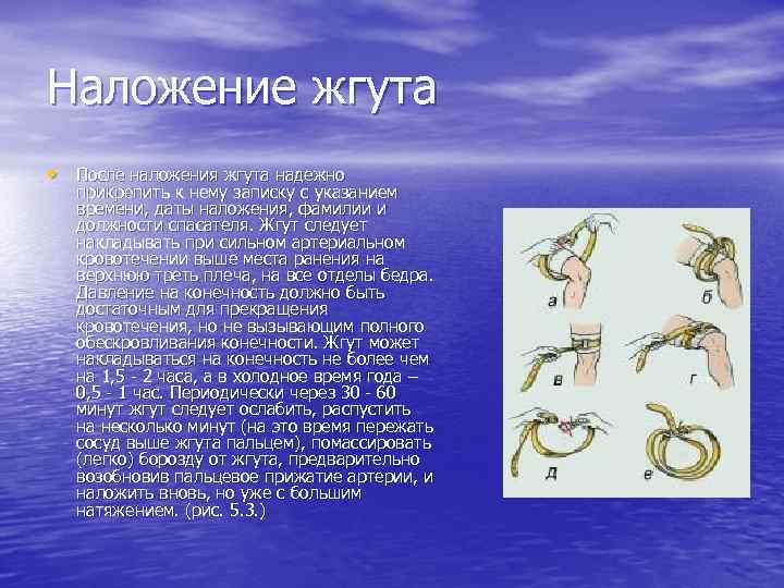 Наложение жгута • После наложения жгута надежно прикрепить к нему записку с указанием времени,