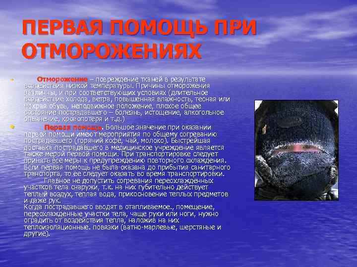 ПЕРВАЯ ПОМОЩЬ ПРИ ОТМОРОЖЕНИЯХ • • Отморожение – повреждение тканей в результате воздействия низкой