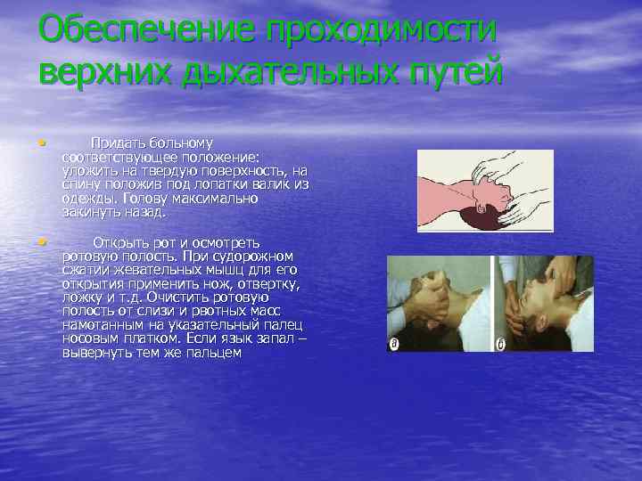 Обеспечение проходимости верхних дыхательных путей • Придать больному соответствующее положение: уложить на твердую поверхность,